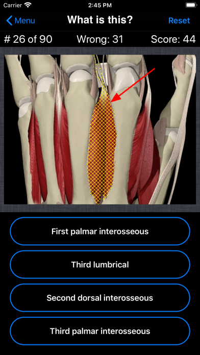 Anatomy Hand Quizのおすすめ画像3