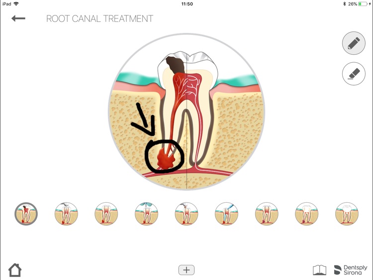 Endo IQ® App - Taiwan screenshot-6