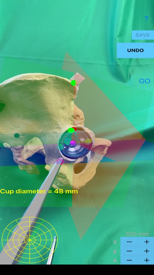#1. ScrewCupNaviAR (iOS) 由: ORTHOPRACTIS.COM SINGLE MEMBER P.C.