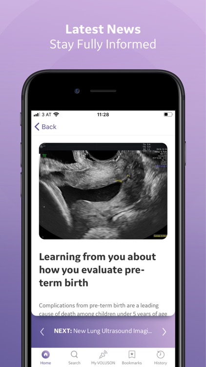 GE Voluson Club screenshot-3