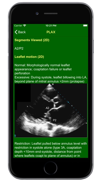 EchoCalc screenshot-7