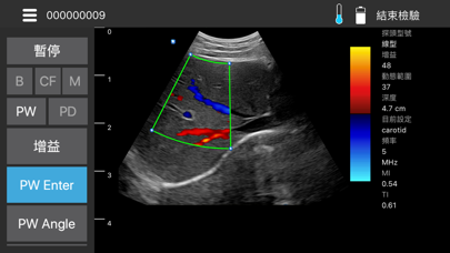 Screenshot #2 pour MediConnect - ASUS Ultrasound