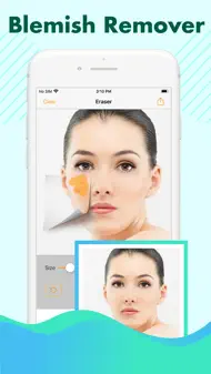 Object Removal Photo Eraser iphone bilder 1