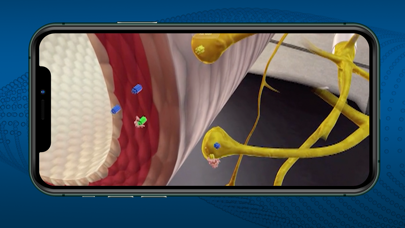 ImmerseRx: Live Spectator Screenshot