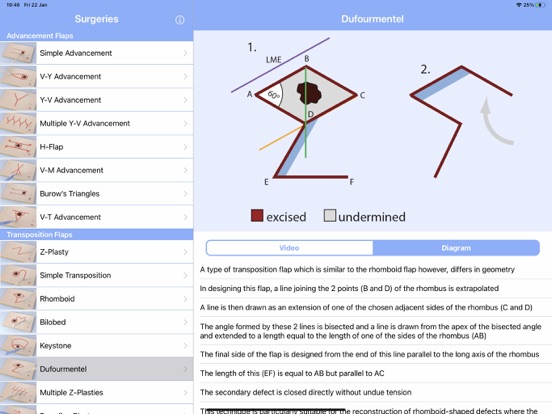 Screenshot #4 pour Surgical Flaps