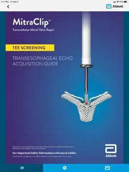 Game screenshot MitraClip™ Assist hack