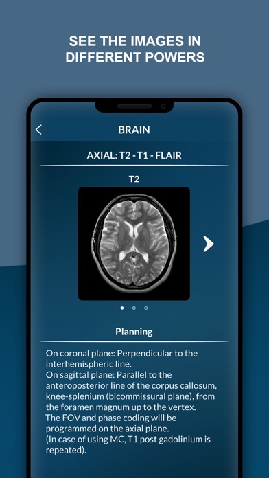 MRI - Protocolos de Resonancia Screenshot