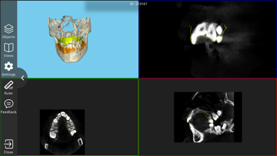 ICC Imaging Case Collaboration Screenshot