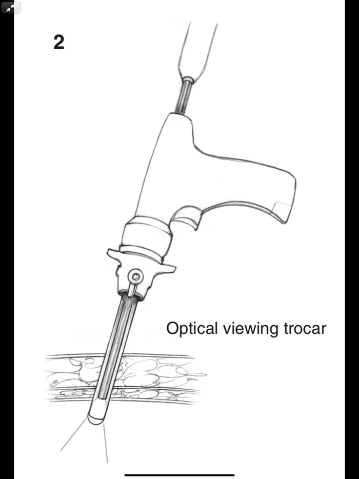 Atlas of Min. Invasive Surgery