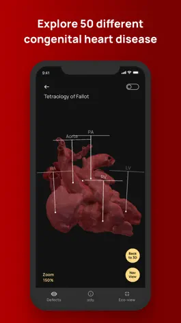 Game screenshot Congenital heARts hack