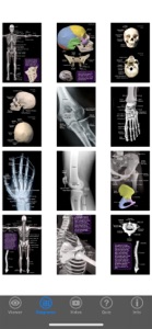 Skeletal Anatomy 3D screenshot #5 for iPhone