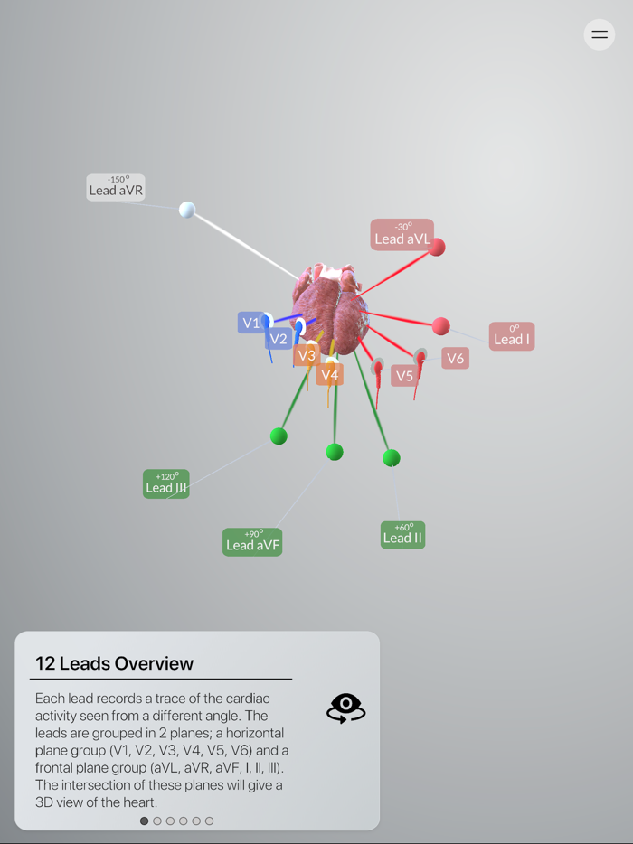 3D ECG Leads