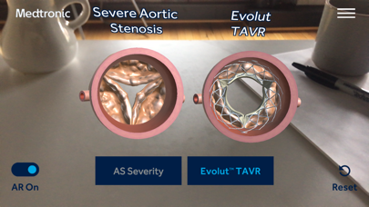 AS TAVR Education Screenshot