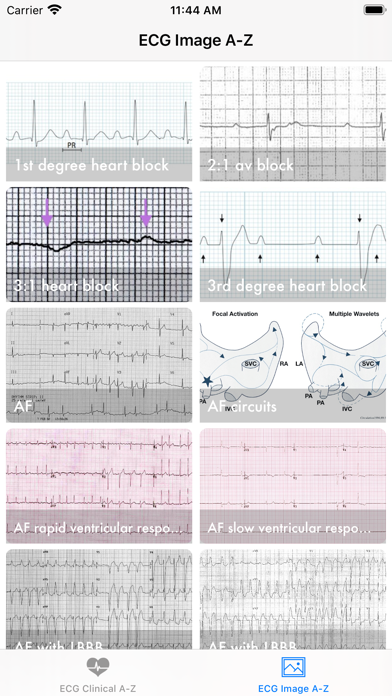 Screenshot #3 pour ECG A-Z Pro