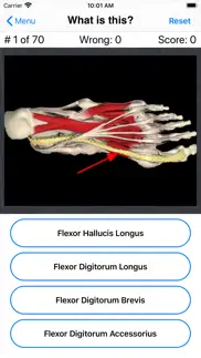 How to cancel & delete anatomy foot quiz 4
