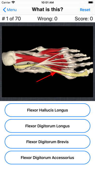 Anatomy Foot Quizのおすすめ画像4