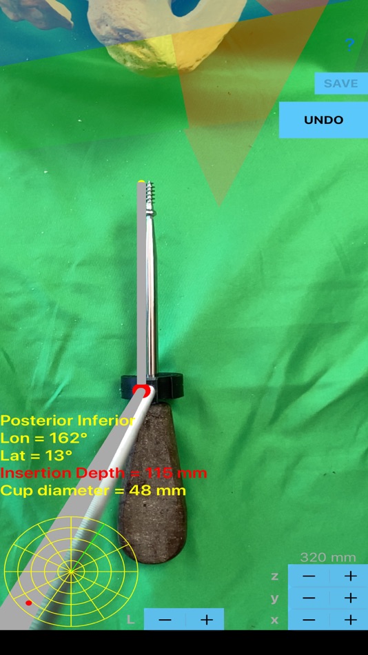 #2. ScrewCupNaviAR (iOS) 由: ORTHOPRACTIS.COM SINGLE MEMBER P.C.