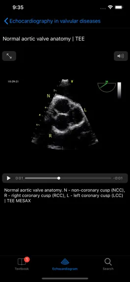 Game screenshot CARDIO3®Echocardiography hack