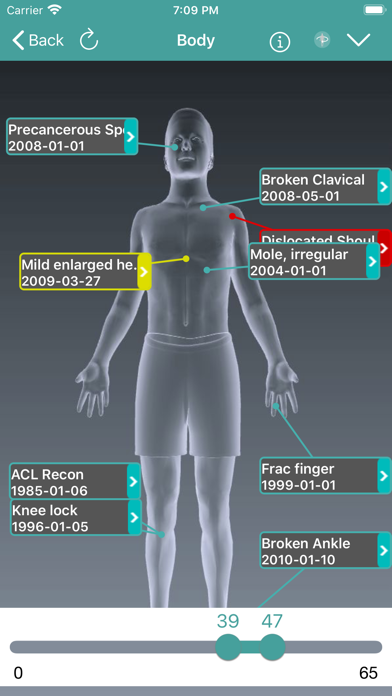 mChartsHealth Screenshot