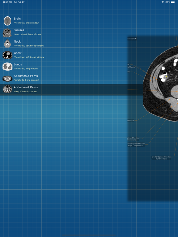 Screenshot #4 pour X-Anatomy Pro