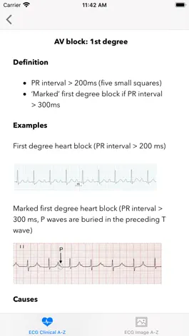 Game screenshot ECG A-Z Pro apk