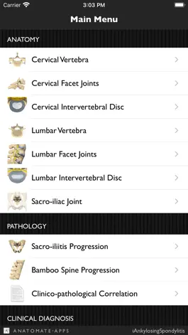 Game screenshot iAnkylosingSpondylitis Pro apk