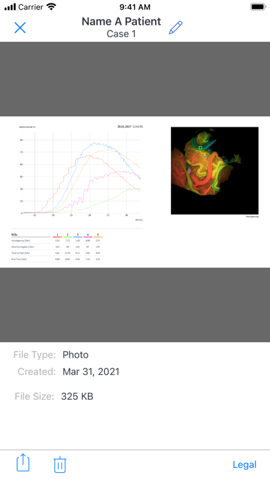 ZEISS Transfer Screenshot