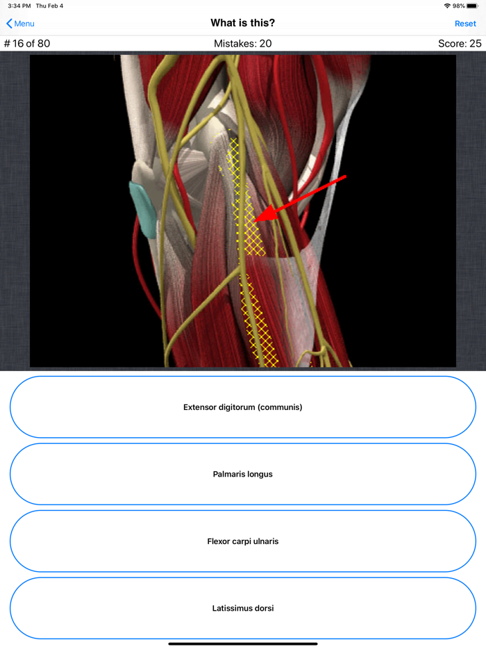 Anatomy Shoulder Quiz