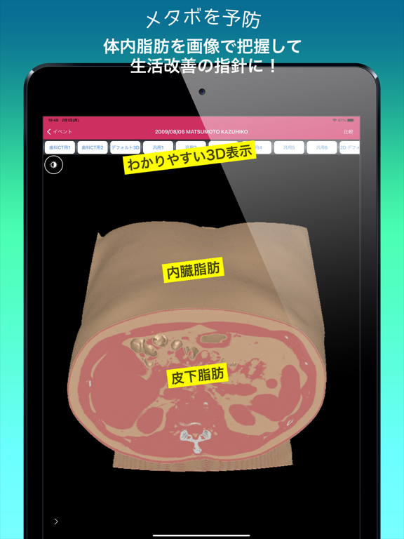 Screenshot #5 pour MedalVision Personal Med Image