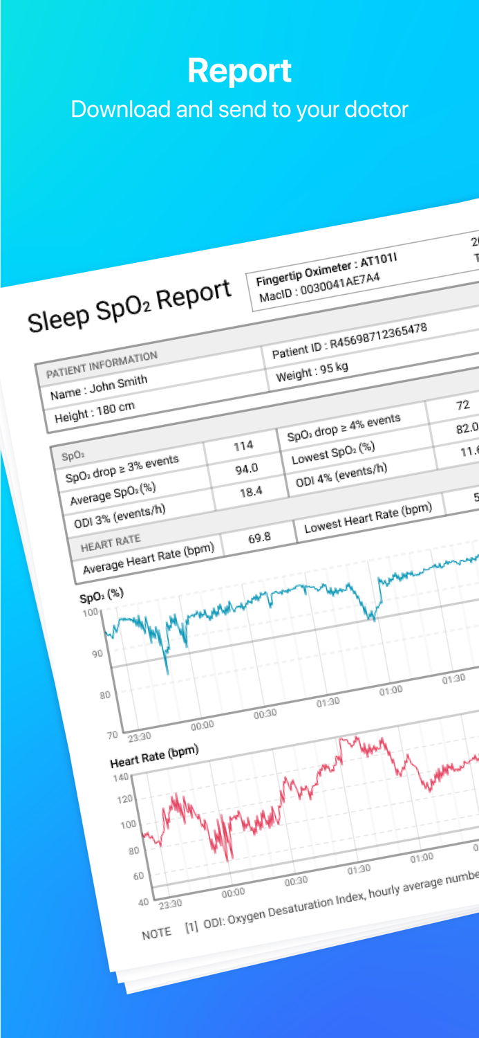 View Tracker SpO2 and Pulse rate