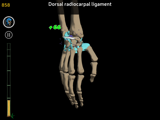 Anatomy Ninja Upper Limbのおすすめ画像2