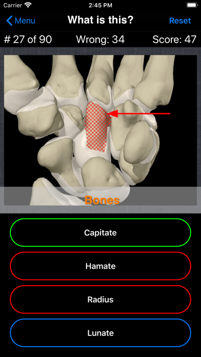 Anatomy Hand Quizのおすすめ画像4