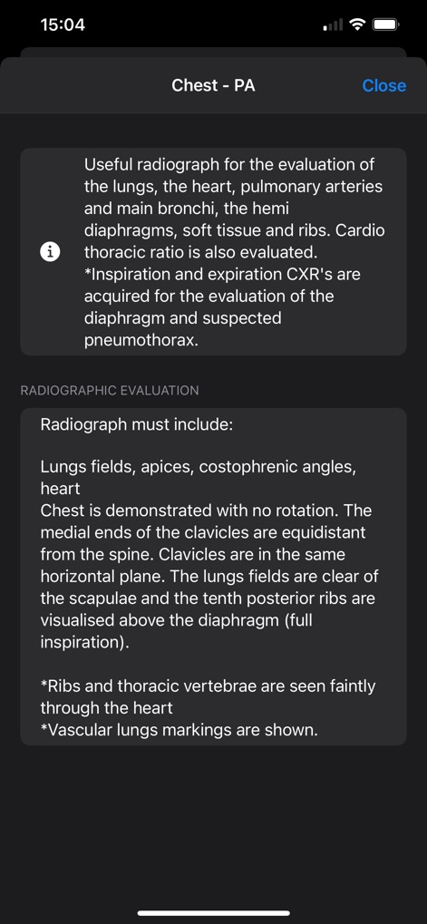 Xray Anatomy - Gain expert knowledge with detailed descriptions of radiographic utility and systematic 'Radiographic Evaluation' criteria, offering essential insights for interpreting views such as the Chest - PA.