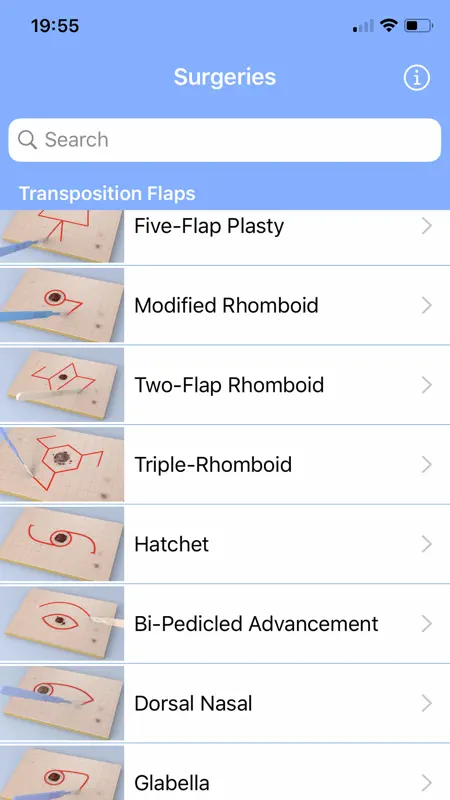 Surgical Flaps screenshot 3 of 3