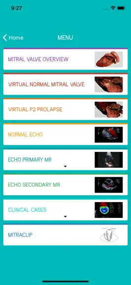 Game screenshot Mitral View apk