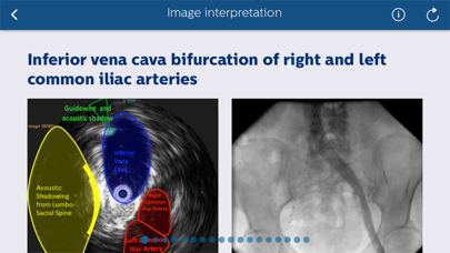 Philips Venous IVUS Tutor Screenshot