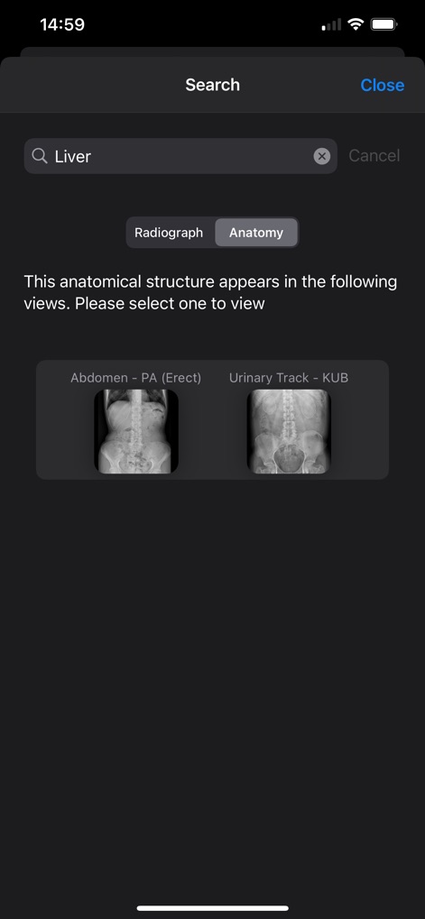 Xray Anatomy - Observe the app's efficient search functionality, allowing users to quickly find specific anatomical structures like the 'Liver' and navigate to corresponding radiographic views like 'Abdomen - PA (Erect)'.