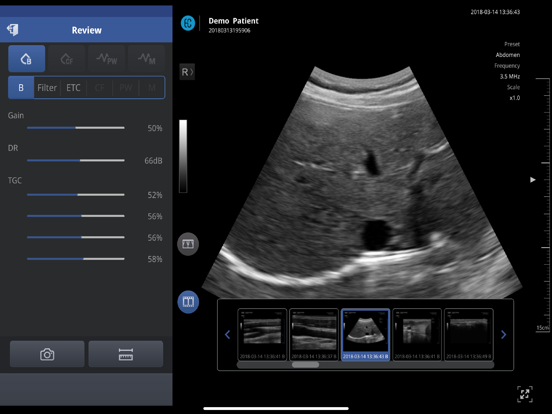 SONON X Ultrasound App US / KR iPad screenshot 3 - Medical app