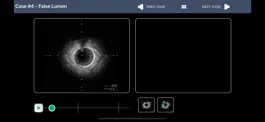 Game screenshot IVUS + Physiology Pro hack