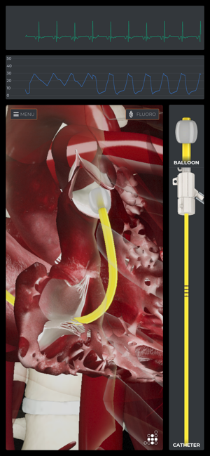 Mentice Right Heart Cath(圖2)-速報App