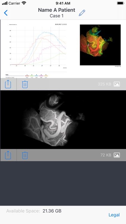 ZEISS Transfer