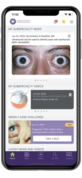 Game screenshot AAO Ophthalmic Education mod apk
