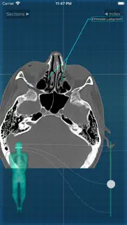 x-anatomy pro problems & solutions and troubleshooting guide - 2