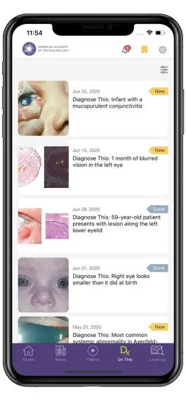 Game screenshot AAO Ophthalmic Education hack