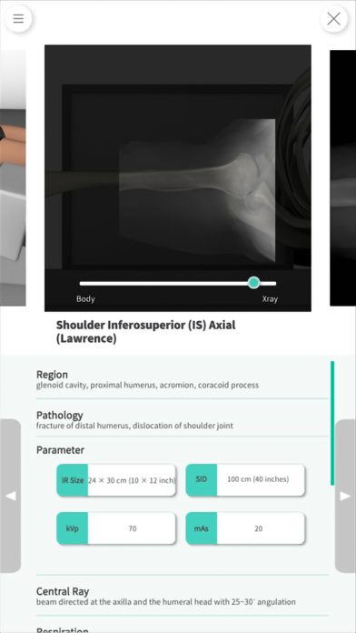 Navi Radiography Lite Screenshot