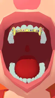 gold grillz problems & solutions and troubleshooting guide - 4