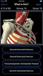 anatomy spine quiz iphone screenshot 3