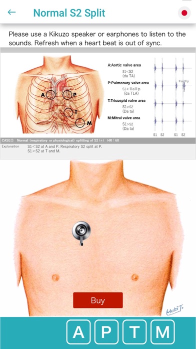 Ausculaide Screenshot