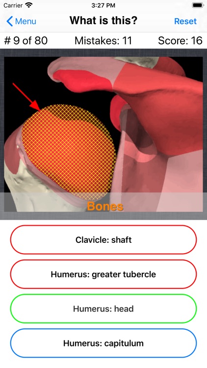 Anatomy Shoulder Quiz screenshot-5