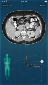 x-anatomy pro problems & solutions and troubleshooting guide - 3